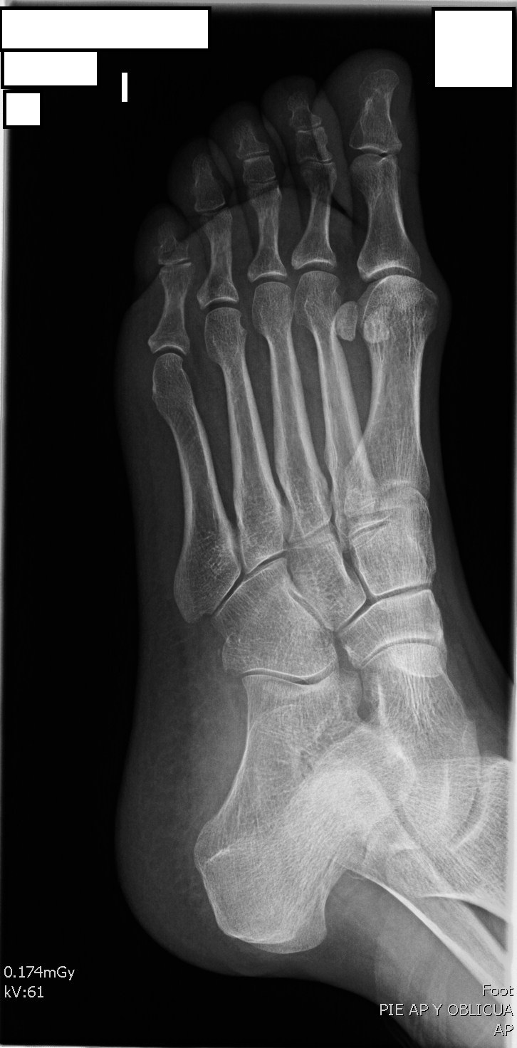 Posicionamiento Oblicua Medial de Pie